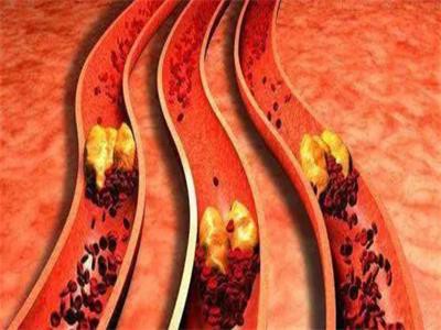 preventarteriesfromgettingclogged